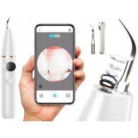 Odstranjevalec zobnega kamna za domačo uporabo