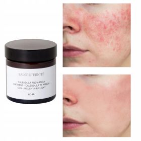 SAINT ÉTERNITÉ Pomirjujoče mazilo z izvlečkom ognjiča