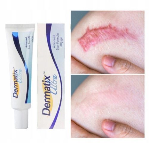 Dermatix Ultra, gel za zdravljenje brazgotin, 15g
