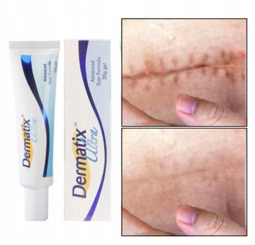 Dermatix Ultra, silikonski gel za zdravljenje brazgotin, 2 x 15g